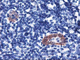 LMCD1 Antibody in Immunohistochemistry (Paraffin) (IHC (P))