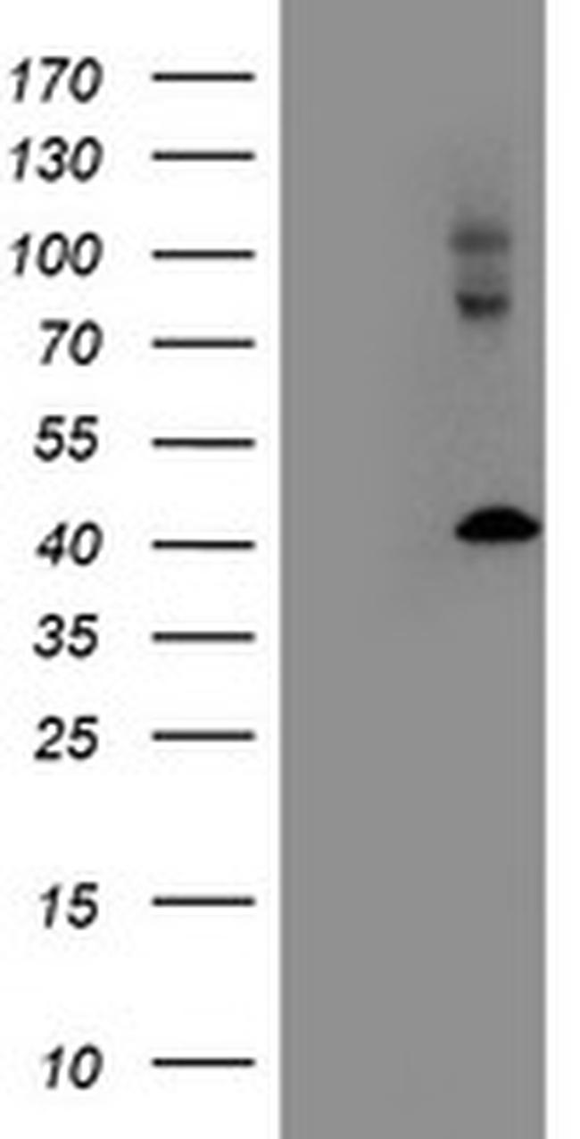 LMCD1 Antibody in Western Blot (WB)