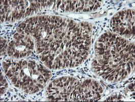 LMO2 Antibody in Immunohistochemistry (Paraffin) (IHC (P))