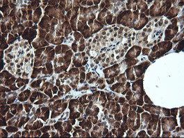 LMO2 Antibody in Immunohistochemistry (Paraffin) (IHC (P))