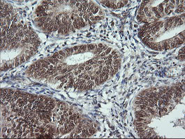 LMO2 Antibody in Immunohistochemistry (Paraffin) (IHC (P))