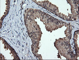 LMO2 Antibody in Immunohistochemistry (Paraffin) (IHC (P))