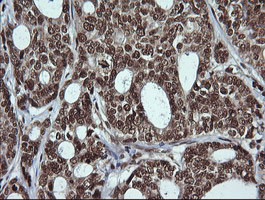 LMO2 Antibody in Immunohistochemistry (Paraffin) (IHC (P))