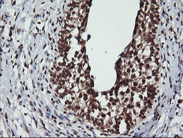 LMO2 Antibody in Immunohistochemistry (Paraffin) (IHC (P))