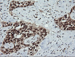 LMO2 Antibody in Immunohistochemistry (Paraffin) (IHC (P))