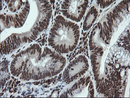 LMO2 Antibody in Immunohistochemistry (Paraffin) (IHC (P))