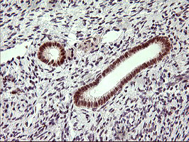 LMO2 Antibody in Immunohistochemistry (Paraffin) (IHC (P))