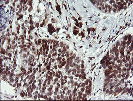 LMO2 Antibody in Immunohistochemistry (Paraffin) (IHC (P))