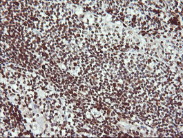 LMO2 Antibody in Immunohistochemistry (Paraffin) (IHC (P))