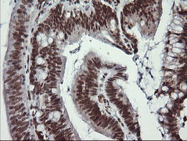 LMO2 Antibody in Immunohistochemistry (Paraffin) (IHC (P))