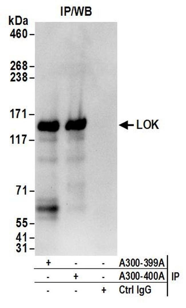 LOK Antibody in Western Blot (WB)