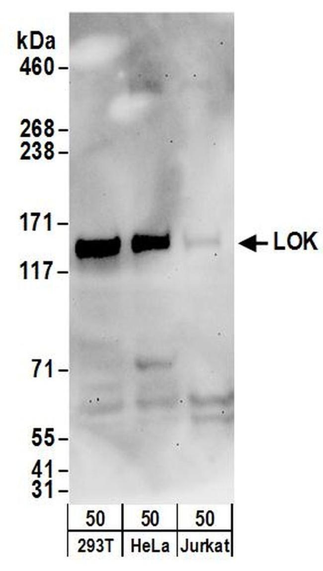 LOK Antibody in Western Blot (WB)