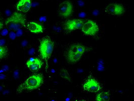 LOX Antibody in Immunocytochemistry (ICC/IF)