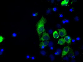 LOX Antibody in Immunocytochemistry (ICC/IF)