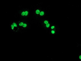 LOX Antibody in Immunocytochemistry (ICC/IF)