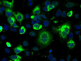 LOX Antibody in Immunocytochemistry (ICC/IF)