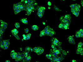 LOX Antibody in Immunocytochemistry (ICC/IF)