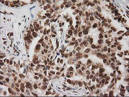 LOX Antibody in Immunohistochemistry (Paraffin) (IHC (P))