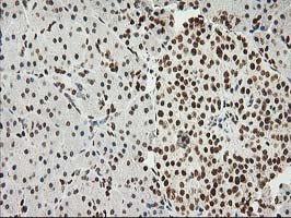 LOX Antibody in Immunohistochemistry (Paraffin) (IHC (P))