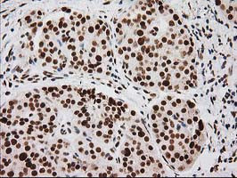 LOX Antibody in Immunohistochemistry (Paraffin) (IHC (P))