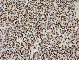 LOX Antibody in Immunohistochemistry (Paraffin) (IHC (P))