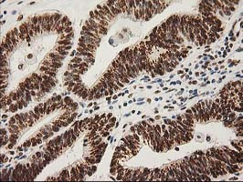 LOX Antibody in Immunohistochemistry (Paraffin) (IHC (P))