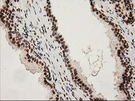 LOX Antibody in Immunohistochemistry (Paraffin) (IHC (P))