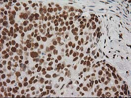 LOX Antibody in Immunohistochemistry (Paraffin) (IHC (P))