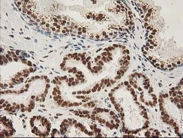 LOX Antibody in Immunohistochemistry (Paraffin) (IHC (P))