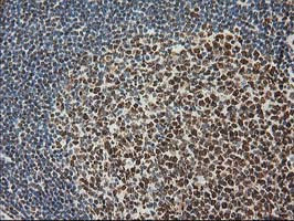 LOX Antibody in Immunohistochemistry (Paraffin) (IHC (P))