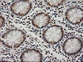 LOX Antibody in Immunohistochemistry (Paraffin) (IHC (P))