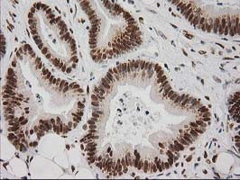 LOX Antibody in Immunohistochemistry (Paraffin) (IHC (P))