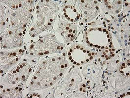 LOX Antibody in Immunohistochemistry (Paraffin) (IHC (P))