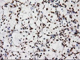 LOX Antibody in Immunohistochemistry (Paraffin) (IHC (P))