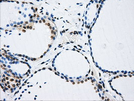 LOX Antibody in Immunohistochemistry (Paraffin) (IHC (P))