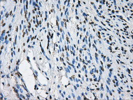 LOX Antibody in Immunohistochemistry (Paraffin) (IHC (P))