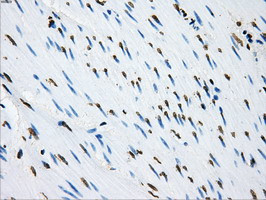 LOX Antibody in Immunohistochemistry (Paraffin) (IHC (P))