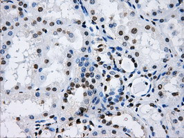 LOX Antibody in Immunohistochemistry (Paraffin) (IHC (P))