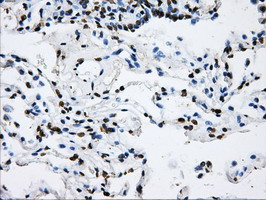 LOX Antibody in Immunohistochemistry (Paraffin) (IHC (P))