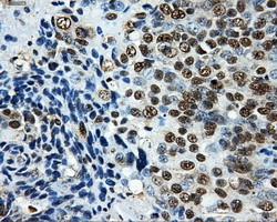 LOX Antibody in Immunohistochemistry (Paraffin) (IHC (P))