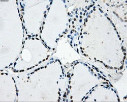 LOX Antibody in Immunohistochemistry (Paraffin) (IHC (P))