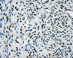 LOX Antibody in Immunohistochemistry (Paraffin) (IHC (P))