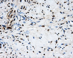 LOX Antibody in Immunohistochemistry (Paraffin) (IHC (P))