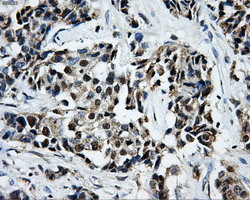 LOX Antibody in Immunohistochemistry (Paraffin) (IHC (P))