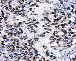 LOX Antibody in Immunohistochemistry (Paraffin) (IHC (P))