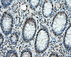 LOX Antibody in Immunohistochemistry (Paraffin) (IHC (P))