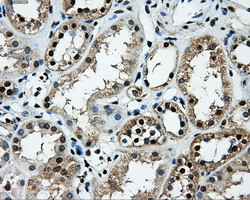 LOX Antibody in Immunohistochemistry (Paraffin) (IHC (P))