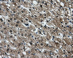 LOX Antibody in Immunohistochemistry (Paraffin) (IHC (P))