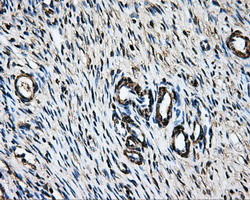 LOX Antibody in Immunohistochemistry (Paraffin) (IHC (P))