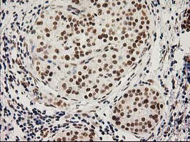 LOX Antibody in Immunohistochemistry (Paraffin) (IHC (P))